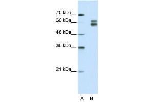 MSH2 antibody used at 1. (MSH2 anticorps)
