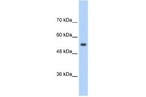 WB Suggested Anti-SLC13A3 Antibody Titration:  2. (SLC13A3 anticorps  (Middle Region))