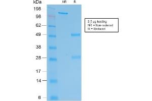 SDS-PAGE Analysis Purified hCG beta Mouse Recombinant Monoclonal Antibody (rHCGb/54).