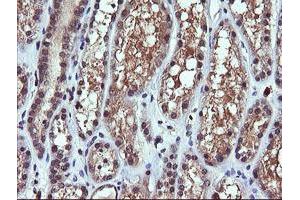 Image no. 2 for anti-Phosphoinositide-3-Kinase, Catalytic, gamma Polypeptide (PIK3CG) antibody (ABIN1500203)