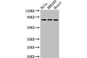 Western Blot Positive WB detected in: Hela whole cell lysate, HEK293 whole cell lysate, Rat heart tissue All lanes: C1R antibody at 3 μg/mL Secondary Goat polyclonal to rabbit IgG at 1/50000 dilution Predicted band size: 81 kDa Observed band size: 81 kDa (C1R anticorps  (AA 65-192))
