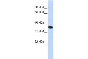WB Suggested Anti-C21orf59  Antibody Titration: 0. (C21orf59 anticorps  (N-Term))