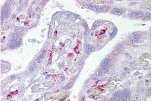 Immunohistochemistry with Placenta tissue at an antibody concentration of 5µg/ml using anti-ING3 antibody (ARP33346_P050) (ING3 anticorps  (N-Term))