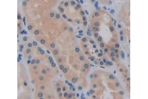 IHC-P analysis of Human Tissue, with DAB staining. (LCN12 anticorps  (AA 61-184))