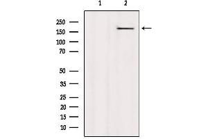 Western blot analysis of extracts from HepG2, using CAMSAP2 Antibody. (CAMSAP2 anticorps  (C-Term))
