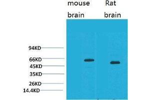 Western Blot (WB) analysis of 1) Mouse Brain Tissue, 2)Rat Brain Tissue with EAAT2 Rabbit Polyclonal Antibody diluted at 1:2000. (SLC1A2 anticorps)