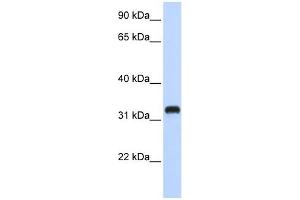 C21ORF62 antibody used at 1 ug/ml to detect target protein. (C21orf62 anticorps  (Middle Region))