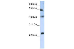 Tetraspanin 3 antibody used at 1 ug/ml to detect target protein. (Tetraspanin 3 anticorps  (Middle Region))