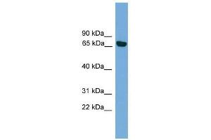 Western Blot showing PRKCI antibody used at a concentration of 1-2 ug/ml to detect its target protein. (PKC iota anticorps  (Middle Region))