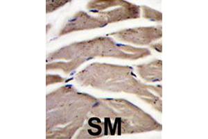 Formalin-fixed and paraffin-embedded human skeletal muscle reacted with PFKM polyclonal antibody  , which was peroxidase-conjugated to the secondary antibody, followed by DAB staining. (PFKM anticorps  (C-Term))