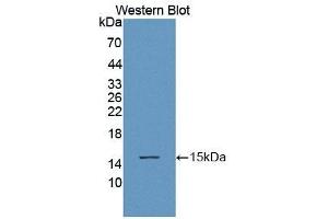 Detection of Recombinant ACYP1, Human using Polyclonal Antibody to Acylphosphatase 1, Erythrocyte (ACYP1)