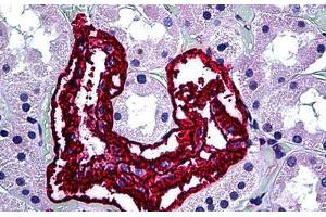 Human Kidney: Formalin-Fixed, Paraffin-Embedded (FFPE) (Inhibin alpha anticorps)
