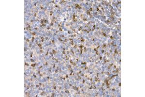 Immunohistochemistry of paraffin-embedded human tonsil using LTBR Rabbit pAb (ABIN6129412, ABIN6143379, ABIN6143381 and ABIN6220987) at dilution of 1:25 (40x lens). (LTBR anticorps  (AA 31-227))