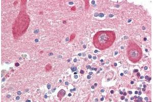 Human Brain, Cerebellum (formalin-fixed, paraffin-embedded) stained with MAP2K1 antibody ABIN461964 at 10 ug/ml followed by biotinylated goat anti-rabbit IgG secondary antibody ABIN481713, alkaline phosphatase-streptavidin and chromogen.