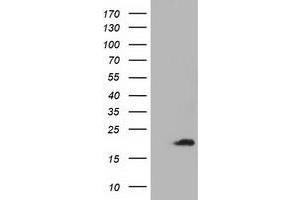 Western Blotting (WB) image for anti-Acireductone Dioxygenase 1 (ADI1) antibody (ABIN1496483) (ADI1 anticorps)