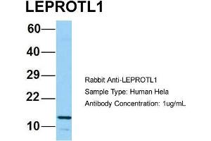 Host: Rabbit Target Name: LEPROTL1 Sample Type: Human Hela Antibody Dilution: 1. (LEPROTL1 anticorps  (N-Term))