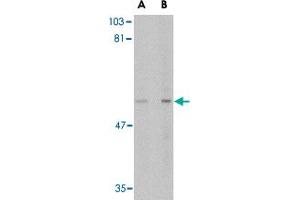 Western blot analysis of LGI4 in rat brain tissue lysate with LGI4 polyclonal antibody  at (A) 1 and (B) 2 ug/mL . (LGI4 anticorps  (C-Term))