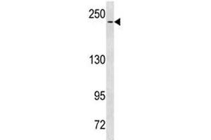 NOTCH3 antibody western blot analysis in HeLa lysate.