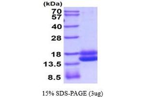 Cystatin C (CST3) (AA 21-140) (Active) protein (His tag)