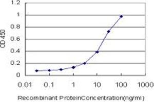 Detection limit for recombinant GST tagged HDAC8 is approximately 0.