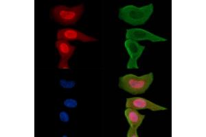ABIN6255588 and ABIN6267234 staining Hela cells(30 min of UV treatment) by IF/ICC.