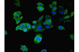 Immunofluorescence staining of HepG2 cells with ABIN7142083 at 1:200, counter-stained with DAPI.