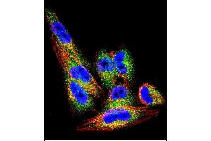 Confocal immunofluorescent analysis of TI Antibody (N-term) (ABIN390664 and ABIN2840958) with  cell followed by Alexa Fluor 488-conjugated goat anti-rabbit lgG (green). (TIMP1 anticorps  (N-Term))