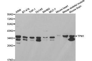 Western blot analysis of extracts of various cell lines, using TPM1 antibody. (Tropomyosin anticorps  (AA 1-245))