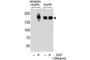 Western blot analysis of extracts from A431 cell, untreated or treated with EGF, using phospho-EGFR antibody (left) or nonphos Ab (right).