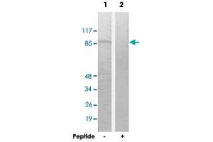 Western blot analysis of extracts from K-562 cells, using TACC1 polyclonal antibody .