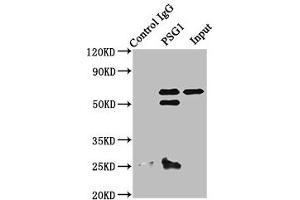 Immunoprecipitating PSG1 in A549 whole cell lysate Lane 1: Rabbit control IgG instead of ABIN7164230 in A549 whole cell lysate. (PSG1 anticorps  (AA 180-419))