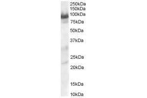 Western Blotting (WB) image for anti-Trafficking Protein, Kinesin Binding 1 (TRAK1) (AA 943-953) antibody (ABIN297384) (TRAK1 anticorps  (AA 943-953))