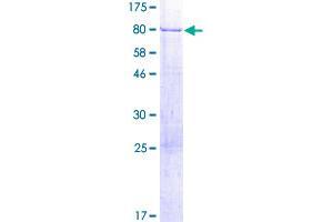 Image no. 1 for TSPY-Like 1 (TSPYL1) (AA 1-438) protein (GST tag) (ABIN1323957)