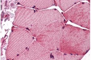 Human Skeletal Muscle: Formalin-Fixed, Paraffin-Embedded (FFPE)