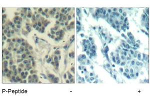 Image no. 3 for anti-Receptor Tyrosine-Protein Kinase ErbB-3 (ERBB3) (pTyr1328) antibody (ABIN319274) (ERBB3 anticorps  (pTyr1328))