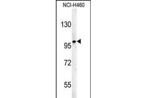ST18 Antibody (N-term) (ABIN651571 and ABIN2840307) western blot analysis in NCI- cell line lysates (35 μg/lane). (ST18 anticorps  (N-Term))