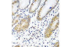 Immunohistochemistry of paraffin-embedded human stomach using ATAD3A antibody at dilution of 1:100 (40x lens). (ATAD3A anticorps)