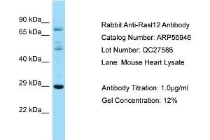 Western Blotting (WB) image for anti-RAS-Like, Family 12 (RASL12) (N-Term) antibody (ABIN2786986) (RASL12 anticorps  (N-Term))