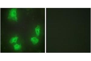 Immunofluorescence analysis of HeLa cells, using CDK5R1 Antibody. (CDK5R1 anticorps  (AA 11-60))