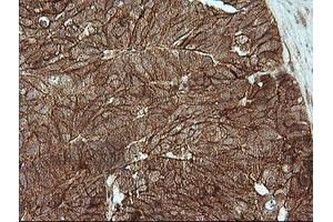 Image no. 3 for anti-Catenin (Cadherin-Associated Protein), beta 1, 88kDa (CTNNB1) antibody (ABIN1496898)