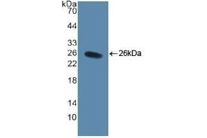 Detection of Recombinant CD40L, Human using Polyclonal Antibody to Cluster Of Differentiation 40 Ligand (CD40L)