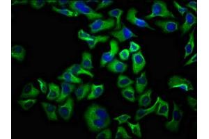 Immunofluorescence staining of Hela cells with ABIN7161187 at 1:100, counter-stained with DAPI. (UNC5D anticorps  (AA 90-212))