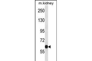 KCNC2 Antibody (C-term) (ABIN657792 and ABIN2846765) western blot analysis in mouse kidney tissue lysates (35 μg/lane). (KCNC2 anticorps  (C-Term))