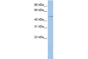 WB Suggested Anti-TSPYL4  Antibody Titration: 0. (TSPY-Like 4 anticorps  (Middle Region))