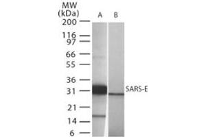 Image no. 1 for anti-SARS-Coronavirus Envelope Protein (SARS-CoV E) (AA 59-70) antibody (ABIN199987) (SARS-Coronavirus Envelope Protein anticorps  (AA 59-70))