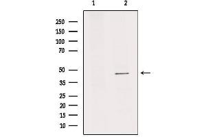 Western blot analysis of extracts from rat brain, using IL11RA Antibody. (IL11RA anticorps  (C-Term))