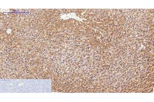 Immunohistochemistry of paraffin-embedded Rat liver tissue using FN1 Monoclonal Antibody at dilution of 1:200. (Fibronectin 1 anticorps)