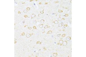 Immunohistochemistry of paraffin-embedded rat brain using SQSTM1 antibody.