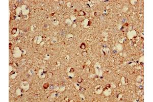 Immunohistochemistry of paraffin-embedded human brain tissue using ABIN7149167 at dilution of 1:100 (COX5A anticorps  (AA 42-150))