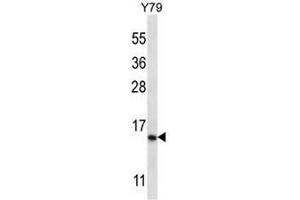 NR2C2AP Antibody (N-term) western blot analysis in Y79 cell line lysates (35µg/lane). (NR2C2AP anticorps  (N-Term))